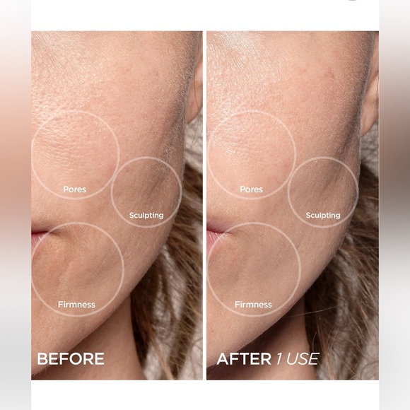 Anti-Aging Plumping Lot - Picture 4 of 8